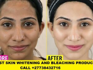 Skin Whitening Products +27738432716