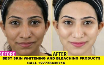 Skin Whitening Products +27738432716